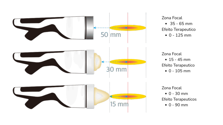 f1 produndidade 2